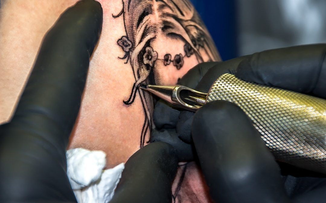 Tattoo Removal – Things to Expect